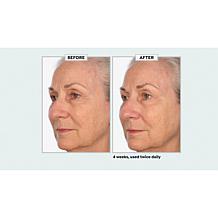 NassifMD Pro Peptide Collagen Serum Auto-Ship®