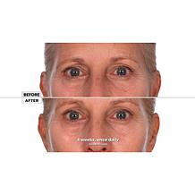 NassifMD® Pure Hydration Night Cream