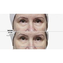 Perfect Cosmetic Perfect Eyes and Day Cream Set