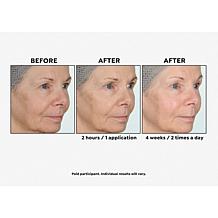 Perlier Black Rice 94.5% Pure Hyaluronic Acid Gel