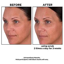 Perlier Black Rice Facial Scrub