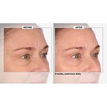 Perlier Black Rice Resurfacing Pads - 60-Count Auto-Ship®