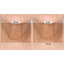 Perlier Black Rice Super Concentrate 9x Hyaluronic Acid Gel