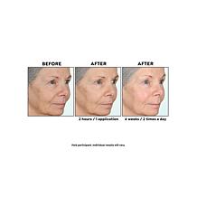 Perlier Black Rice Triple-Size Hyaluronic Acid Gel