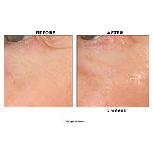 Perlier Black Rice Triple Sized Night Eye Contour Serum