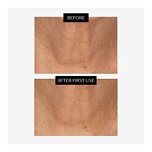 Perlier Jumbo Black Rice Super Concentrate 9x Hyaluronic Acid