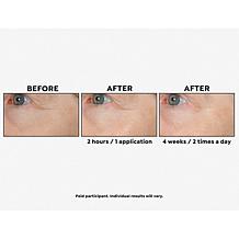 Perlier Megasize Black Rice Hyaluronic Acid Gel