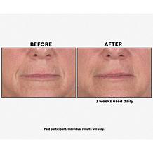 Perlier Royal Elixir Pearls of Youth Alcohol-Free Serum Auto-Ship®