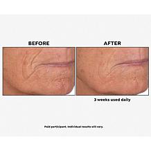 Perlier Supersize Royal Elixir Pearls of Youth Serum