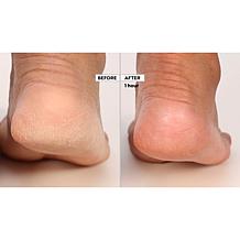 Perlier Supersize Shea and Sweet Almond Milk Body Mousse