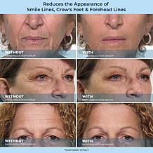 Plexaderm Rapid Reduction Serum 2-pack & Dual Action Cream Auto-Ship®