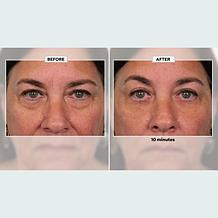 Plexaderm Rapid Reduction Wrinkle Serum 2-pack Auto-Ship®