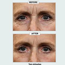 Plexaderm Rapid Reduction Wrinkle Serum 2-pack