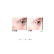 PRAI Ageless Eye Tight Uplift Serum