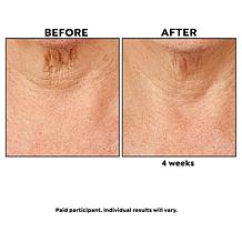 PRAI Ageless Throat Caviar Overnight Recovery Serum