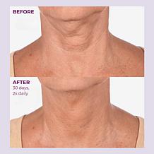 PRAI Beauty Ageless Throat & Decolletage Creme Intensive Gold+