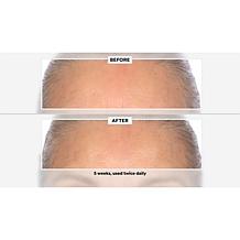 Signature Club A 5 Essentials Cream for Face and Eyes 2-Pack