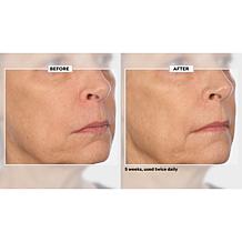 Signature Club A 5 Essentials Cream for Face and Eyes Auto-Ship®