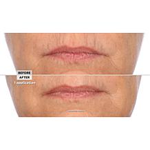 Signature Club A Intensive Lip Fix Cream Auto-Ship®