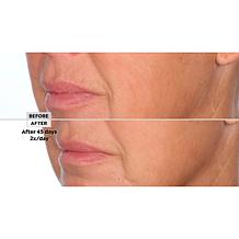 SKINN 3-piece Lab Insider Face Boot Camp Set Auto-Ship®