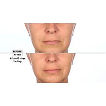 SKINN 3-piece Lab Insider Face Boot Camp Set
