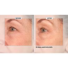 SKINN 30-Day Eye Boot Camp Auto-Ship®