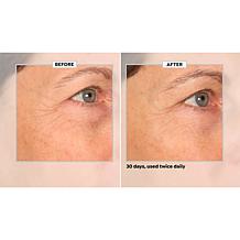 SKINN 30-Day Eye Boot Camp