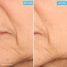 SKINN Age Reset Advanced Night Cream Auto-Ship®