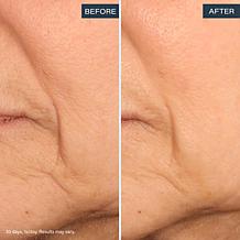 SKINN Age Reset Advanced Night Cream Auto-Ship®