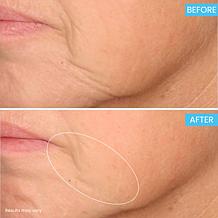 SKINN Age Reset Advanced Night Cream