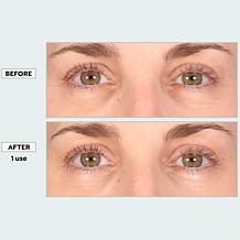 SKINN Age Reset Illuminate Eye Serum