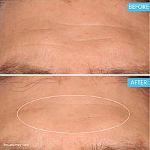 SKINN Age Reset Night Cream and Refill Auto-Ship®