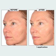 SKINN Age Reset Restore and Protect Day Cream with SPF 30 Auto-Ship®