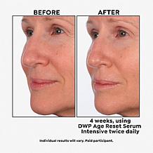 SKINN Age Reset Serum and Headband 2-piece Set