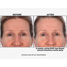SKINN Age Reset Serum