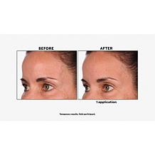 Skinn® Cosmetics DermAppeal® Microderm Beauty Treatment Auto-Ship®