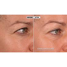 Skinn® Cosmetics DWP Eye Creme Reverse Intensive