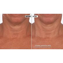 Skinn Cosmetics Neck Amour Defining Serum Auto-Ship®