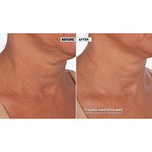 Skinn Cosmetics Neck Amour Defining Serum