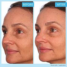 Skinn® Cosmetics Non-Negotiables 2-pack Multi-Acid Resurfacing Pads AS