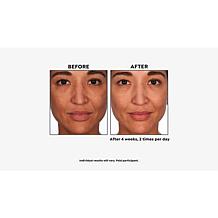Skinn® Cosmetics Non-Negotiables Multi-Acid Resurfacing Pads