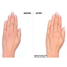 SKINN Dermappeal Body Scrub and Divine Elixir Body Blend AS
