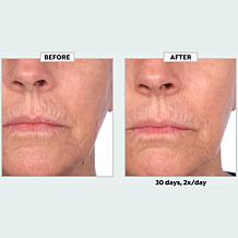 SKINN Divine Elixir Vitamin C Serum