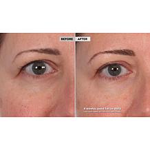 SKINN DWP Eye Creme Reverse Intensive 2-pack Auto-Ship®