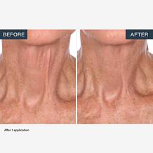 SKINN Neck Amour Advanced Leave-on Mask 1.7 fl. oz.