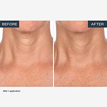 SKINN Neck Amour Advanced Leave-on Mask 1.7 fl. oz.