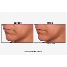 SKINN Non-Negotiables DermAppeal and Glass Effect Treatment Balm Set