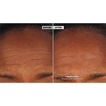 SKINN Non-Negotiables DermAppeal and Glass Effect Treatment Balm Set