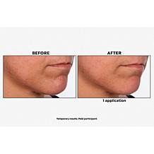 SKINN Non-Negotiables DermAppeal & Glass Effect Treatment Balm Set AS