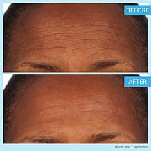 SKINN Non-Negotiables DermAppeal & Makeup Removing Cloths
